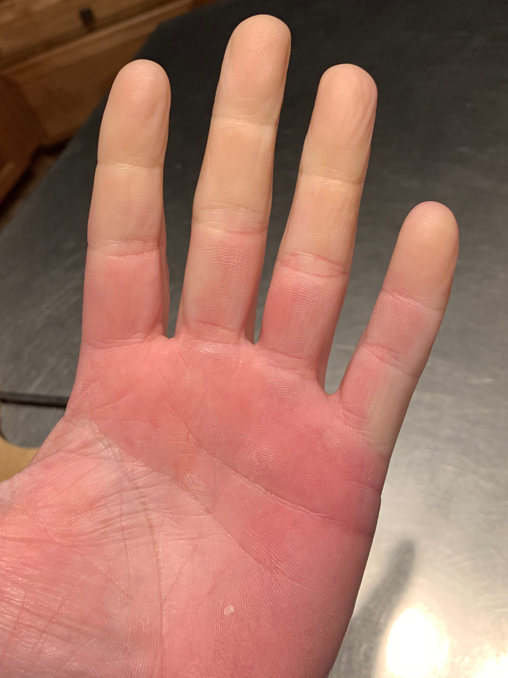 raynauds attack volt heated gloves